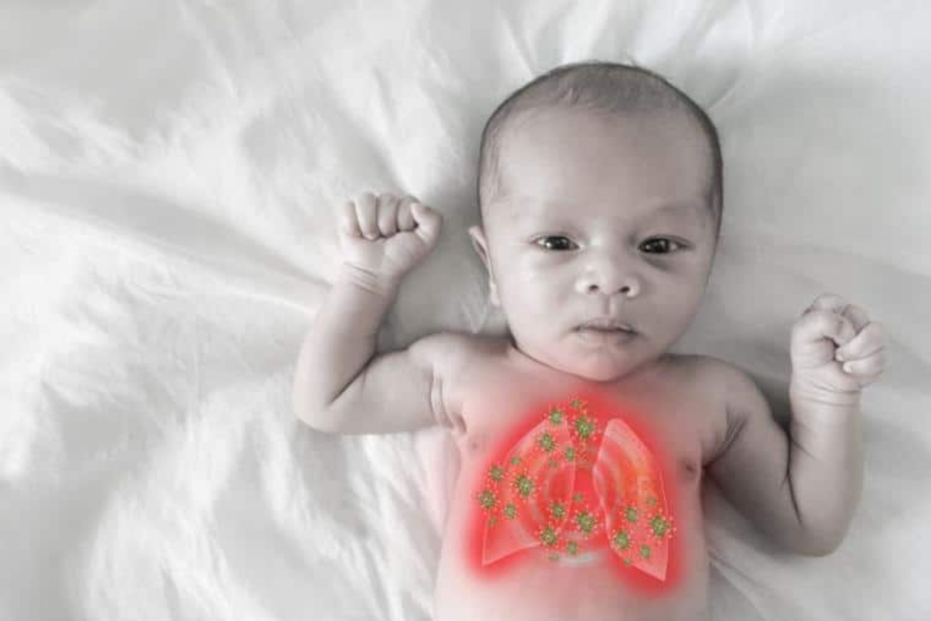 শিশুর নিউমোনিয়া রোগের লক্ষণ ও প্রতিকার